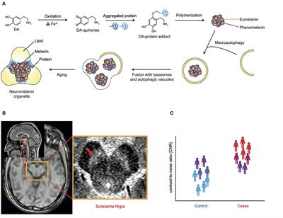 Neuromelanin-Sensitive Magnetic Resonance Imaging in Schizophrenia: A Meta-Analysis of Case-Control Studies